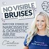 undefined No Visible Bruises