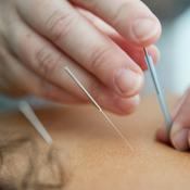 Podcast Acupuncture Wellness